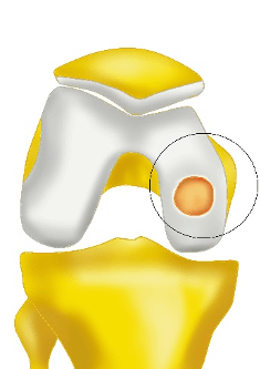 shoulder