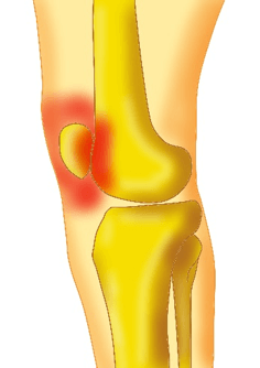 shoulder