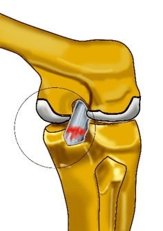 shoulder